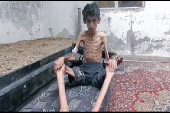   به‌ وێنه‌.. منداڵانی مه‌زایا له‌ برسان ده‌مرن